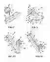 Fig. 28 - Systems for and methods of fusing a sacroiliac joint