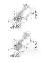 Fig. 63 - Systems for and methods of fusing a sacroiliac joint