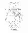 Fig. 69 - Systems for and methods of fusing a sacroiliac joint