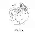 Fig. 74 - Systems for and methods of fusing a sacroiliac joint