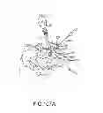 Fig. 76 - Systems for and methods of fusing a sacroiliac joint