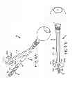 Fig. 80 - Systems for and methods of fusing a sacroiliac joint