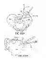 Fig. 83 - Systems for and methods of fusing a sacroiliac joint