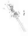 Fig. 07 - MESH SPACER HYBRID