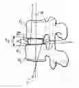 Fig. 01 - INTERBODY SPACER