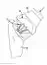 Fig. 01 - Shoulder prosthesis