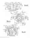 Fig. 07 - Shoulder prosthesis