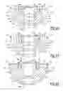 Fig. 09 - Shoulder prosthesis