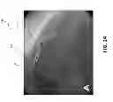 Fig. 28 - METHODS AND SYSTEMS FOR DETERMINING VASCULAR BODILY LUMEN INFORMATION AND GUIDING MEDICAL DEVICES