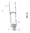 Fig. 31 - METHODS AND SYSTEMS FOR DETERMINING VASCULAR BODILY LUMEN INFORMATION AND GUIDING MEDICAL DEVICES