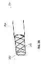 Fig. 33 - METHODS AND SYSTEMS FOR DETERMINING VASCULAR BODILY LUMEN INFORMATION AND GUIDING MEDICAL DEVICES