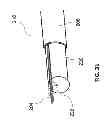 Fig. 35 - METHODS AND SYSTEMS FOR DETERMINING VASCULAR BODILY LUMEN INFORMATION AND GUIDING MEDICAL DEVICES
