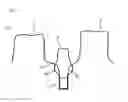 Fig. 02 - Method of modifying the gingival part of a virtual model of a set of teeth