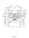 Fig. 04 - Worm drive adjustment for headgear suspension