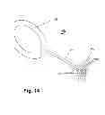 Fig. 14 - Clamping device, in particular for hoses