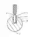 Fig. 01 - DECORATIVE STRING HOLDER DEVICE AND METHOD OF USE