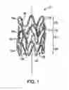 Fig. 02 - Method of making implantable prosthesis with depot retention feature