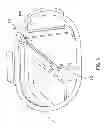 Fig. 07 - DRY GOODS PORTION CONTROL CONTAINER