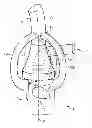 Fig. 01 - Cyclone with a plurality of inlet ducts