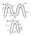 Fig. 07 - Filter arrangement and methods