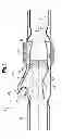 Fig. 04 - Device for distributing fluids in exhaust systems