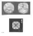 Fig. 07 - Method for determining a cut for a gemstone