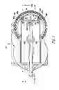 Fig. 02 - Motor housing with integrated gears