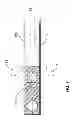Fig. 07 - Dual plectrum systems for stringed instruments