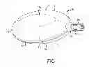 Fig. 02 - Ultrasonic noise device