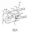 Fig. 05 - Crossbow portable cocking device