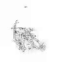 Fig. 02 - Anesthesia machine COabsorber bypass
