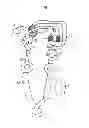 Fig. 07 - Anesthesia machine COabsorber bypass