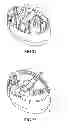 Fig. 09 - Powder dispersion apparatus, method of making and using the apparatus, and components that can be used on the apparatus and other devices