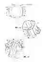 Fig. 25 - Powder dispersion apparatus, method of making and using the apparatus, and components that can be used on the apparatus and other devices