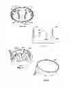 Fig. 35 - Powder dispersion apparatus, method of making and using the apparatus, and components that can be used on the apparatus and other devices