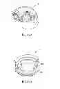 Fig. 52 - Powder dispersion apparatus, method of making and using the apparatus, and components that can be used on the apparatus and other devices