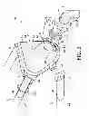 Fig. 04 - Face mask