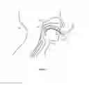 Fig. 06 - Artificial airway