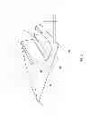 Fig. 03 - Hemorrhoid pain relieving apparatus and method