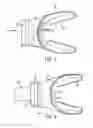 Fig. 04 - Customizable Mouthpiece for Scuba-Divers