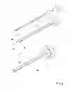 Fig. 04 - System and method for cleaning a cannula during a surgical procedure using a hinged tip