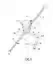 Fig. 06 - WALKING STICK CHAIR