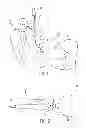 Fig. 02 - Quick change I.V. interface technology