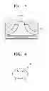 Fig. 04 - METHOD OF MANUFACTURING ROTOR SUCH AS IMPELLER OR TURBINE WHEEL
