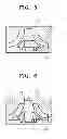 Fig. 05 - METHOD OF MANUFACTURING ROTOR SUCH AS IMPELLER OR TURBINE WHEEL