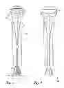 Fig. 03 - Golf bags with a stabilization and reinforcement system and methods to manufacture golf bags with the stabilization and reinforcement system