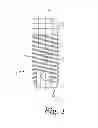 Fig. 02 - Titanium nano-scale etching on an implant surface