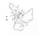 Fig. 08 - Method and apparatus for delivering a shape memory article to a surgical site