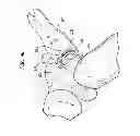 Fig. 09 - Method and apparatus for delivering a shape memory article to a surgical site