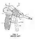 Fig. 02 - Foam dispensing gun